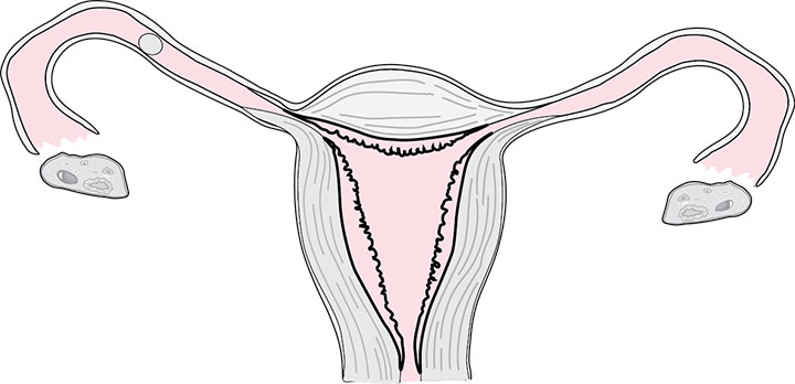 An egg passing down the fallopian tubes