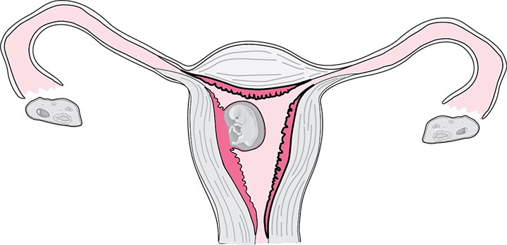 A developing baby in the uterus